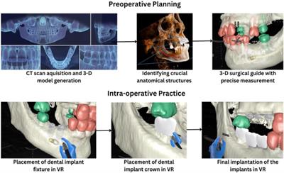 Potential applicability of virtual reality in implant dentistry: a narrative review